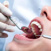 The British Dental Association says while it supports phasing out mercury-containing amalgam fillings - it is concerned about the speed of a proposed EU ban and its disproportionate effect on Northern Ireland compared with the rest of the UK.