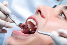 The British Dental Association says while it supports phasing out mercury-containing amalgam fillings - it is concerned about the speed of a proposed EU ban and its disproportionate effect on Northern Ireland compared with the rest of the UK.