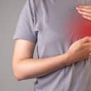 Breast cancer remains the most frequently diagnosed, accounting for nearly a third of all female cancers in NI