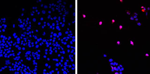 Untreated cancer cells can be seen on the left - and cells treated with the new drug are on the right.
