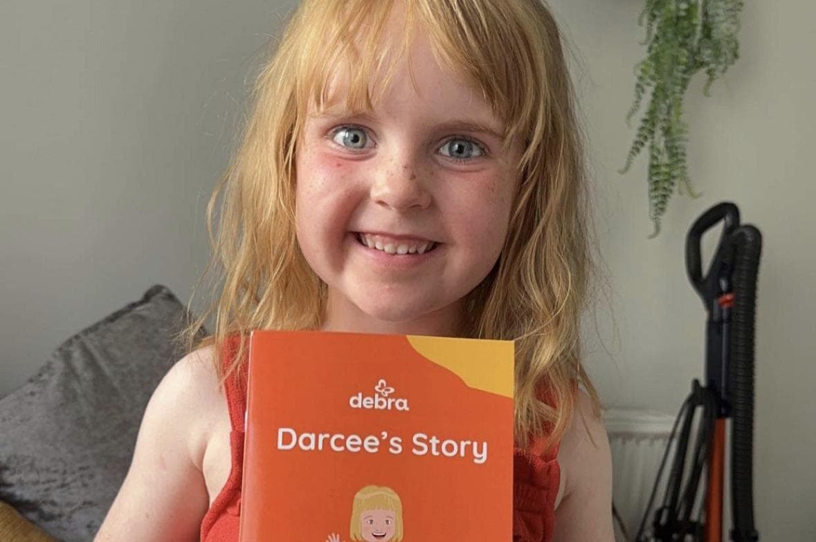 Five-year-old Darcee Birrane is cover star of book explaining her butterfly skin to new classmates