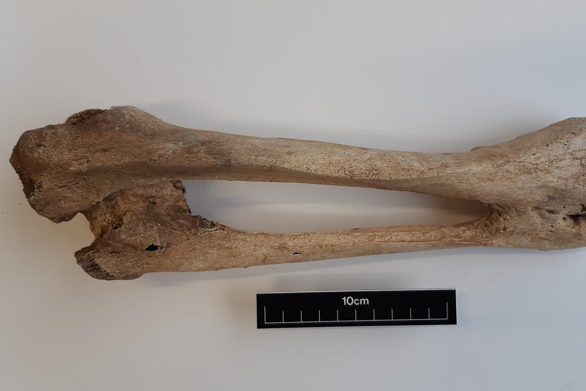 Getting Old Skeleton 1,000 year old skeletons found in Ulster graveyard reveal bone tumour ...