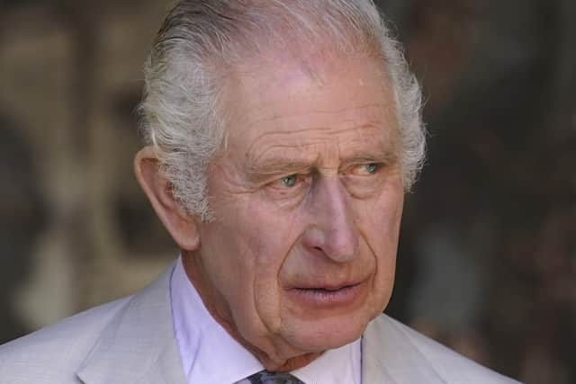King Charles III will attend hospital next week to be treated for an enlarged prostate, Buckingham Palace said