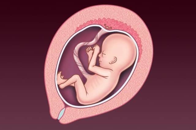 An NHS image of a foetus at 13-20 weeks' gestation. Abortion is now legal in Northern Ireland up until birth 'to prevent grave permanent injury to the physical or mental health of the pregnant woman or girl', or in cases of 'severe fetal impairment'.