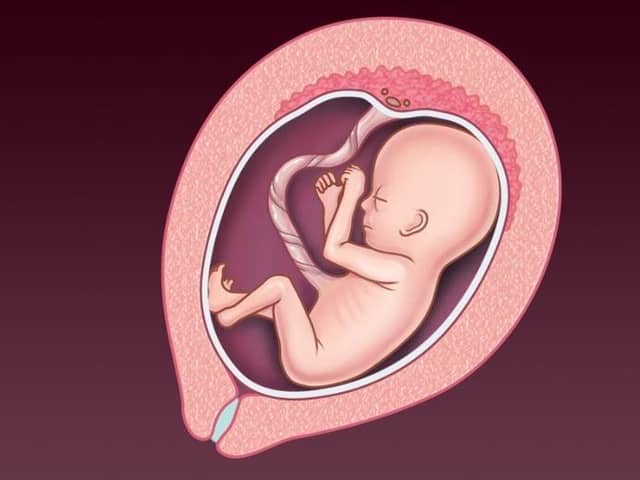 An NHS image of a foetus at 13-20 weeks' gestation. Abortion is now legal in Northern Ireland up until birth 'to prevent grave permanent injury to the physical or mental health of the pregnant woman or girl', or in cases of 'severe fetal impairment'.