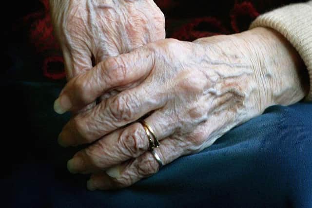 The Alzheimer's Society estimates that about a million people in the UK have dementia