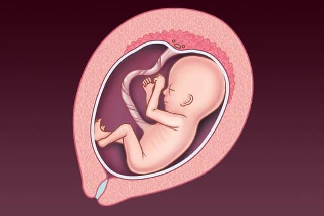 An NHS image of a foetus at 13-20 weeks' gestation. Abortion is now legal in Northern Ireland up until birth 'to prevent grave permanent injury to the physical or mental health of the pregnant woman or girl', or in cases of 'severe fetal impairment'