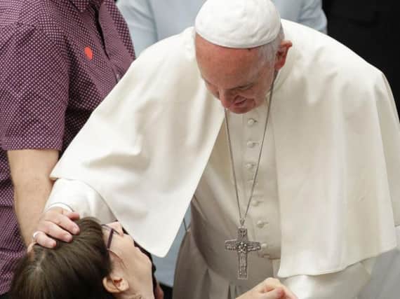 Pope Francis caresses a sick woman during an audience with Huntington's disease sufferers and their families, in the Paul VI Hall, at the Vatican, Thursday, May 18, 2017 i)