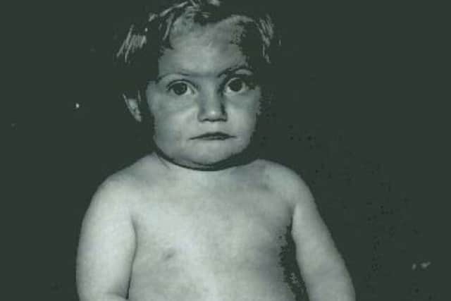 Handout photo issued by Cleveland Police of a police photo of Paul Booth taken in September 1968 showing bruising, months before the child died