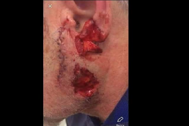 The man suffered horrific injuries and required 50 stitches