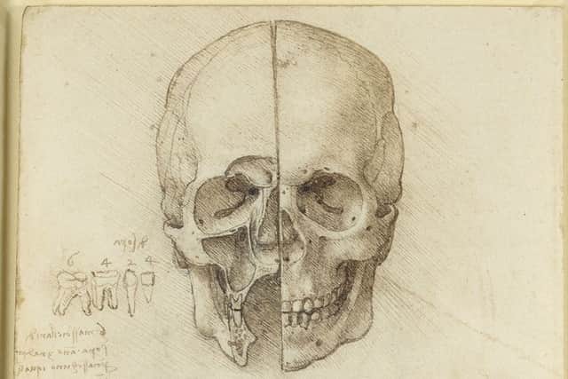 The Skull Sectioned dates from 1489