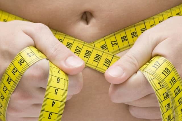 Obesity
