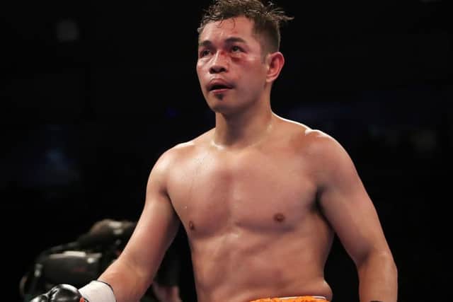 A battered and bruised Nonito Donaire