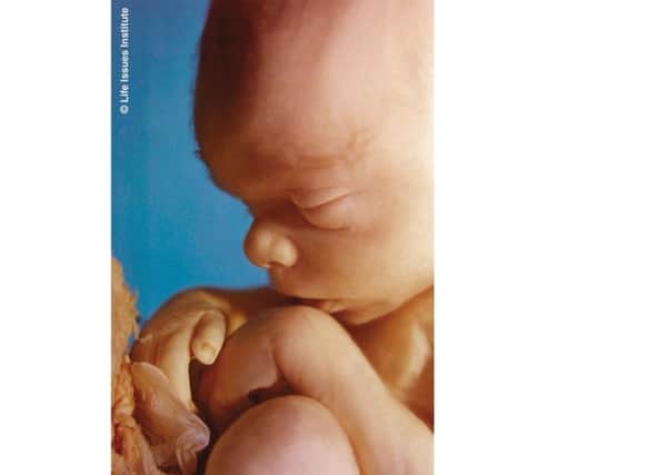 An oncoming human soul: a foetus at 20 weeks