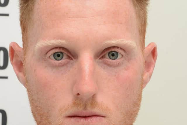 Photo issued by Avon and Somerset Police of Ben Stokes with his injuries after a fight that took place near a nightclub in Bristol last year.