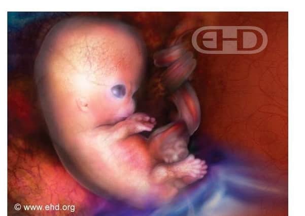 A seven and a half week embryo. Image taken from The Endowment for Human Development as linked to from the website http://abort67.co.uk