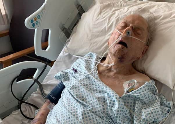 A photo issued by the Metropolitian Police of 
Peter Gouldstone in a hospitial bed after he was attacked and robbed in his own home