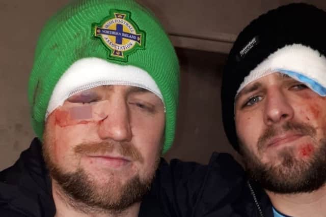 NI fans Andrew Meeke from Dundonald (right) and his brother-in-law Richard Rooney were both attacked