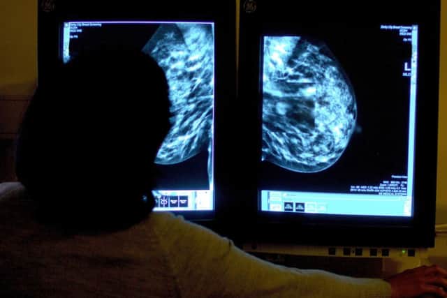 A consultant views the results of a breast cancer screening. Cancer waiting times are the worst on record in NI