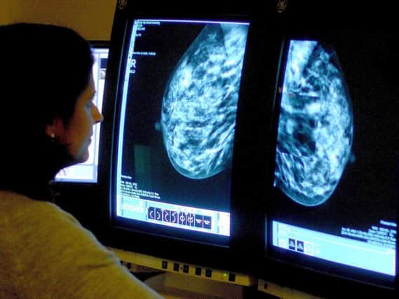 Breast cancer assessment appointments are to be offered in fewer hospitals in Northern Ireland under proposals to consolidate services and reduce waiting times.