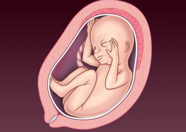 An NHS graphic representation of a foetus developing in the womb between 21 and 24 weeks. In mainland UK, abortion is allowed up to 24 weeks (and beyond that, in what the NHS calls exceptional circumstances)