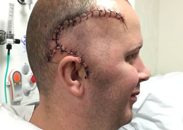 Kevin Carey has undergone specialist neurosurgery as he bids to beat a brain tumour