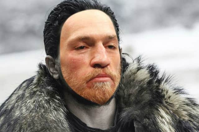 How Conor McGregor would look if he joined the Night's Watch.