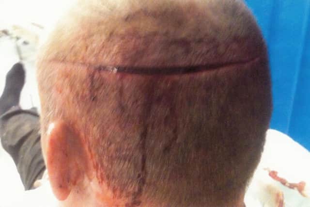 Sgt Wright sustained serious knife wounds to his head.